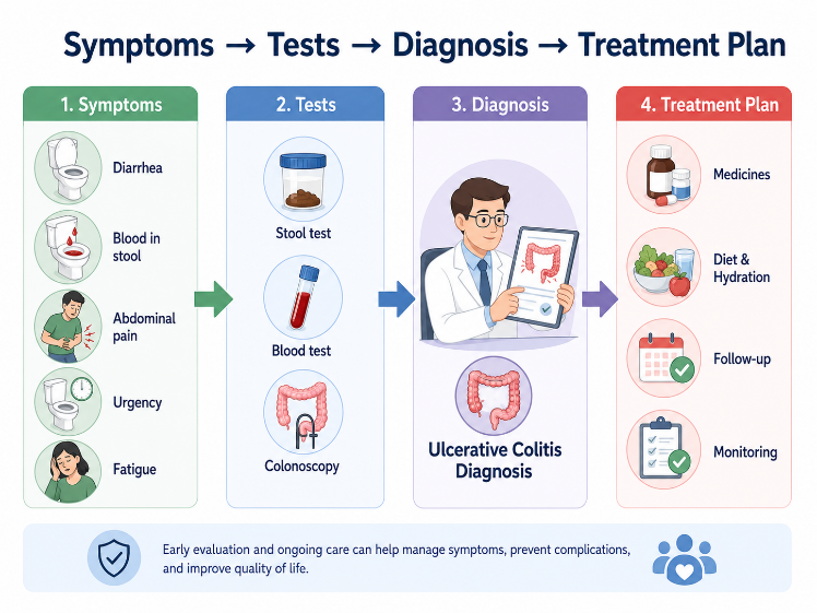 Steps in diagnosis of ulcerative colitis including stool test, blood test and colonoscopy.